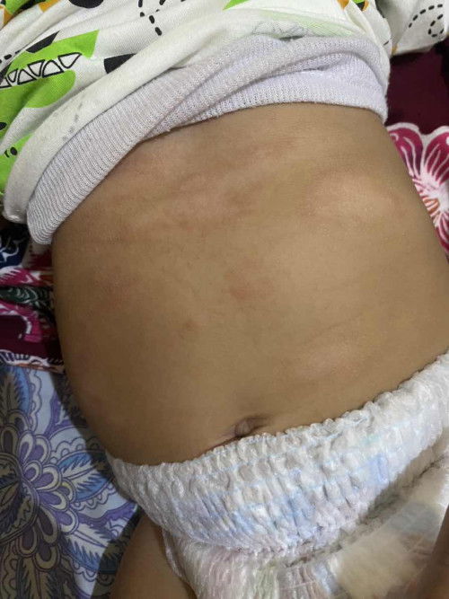Bayi 5 bulan