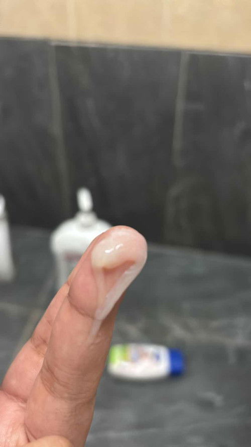 mucus plug
