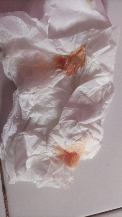 Apakah ada dari ibu2 dsni minggu ke 5-8 flak coklat n merah mudah ?