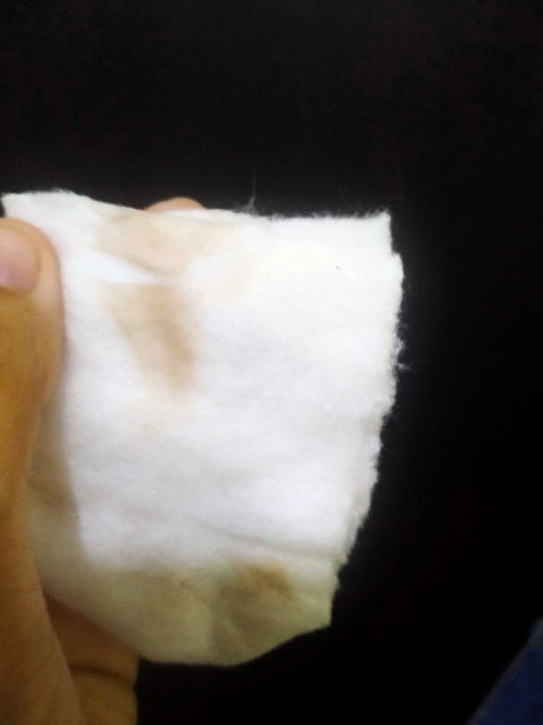 Ada yg pernah ngalamin Flek/Keputihan coklat tanpa kram pas hamil muda?