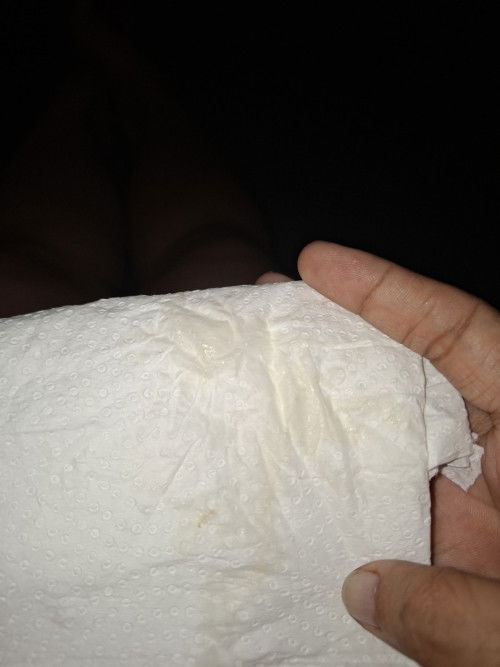 5 weeks preggy po ako normal lang ba magkabahid ng super light brown? Natatakot po kasi ako