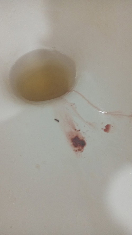 abortus insipiens