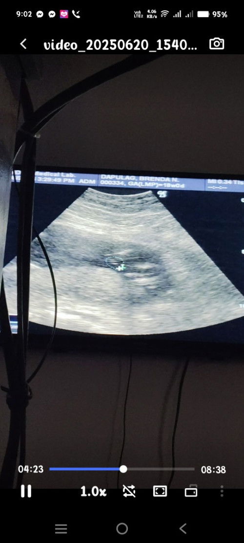 Hello po ask ko lng po ano sa tingin niyo gender ni baby🥰