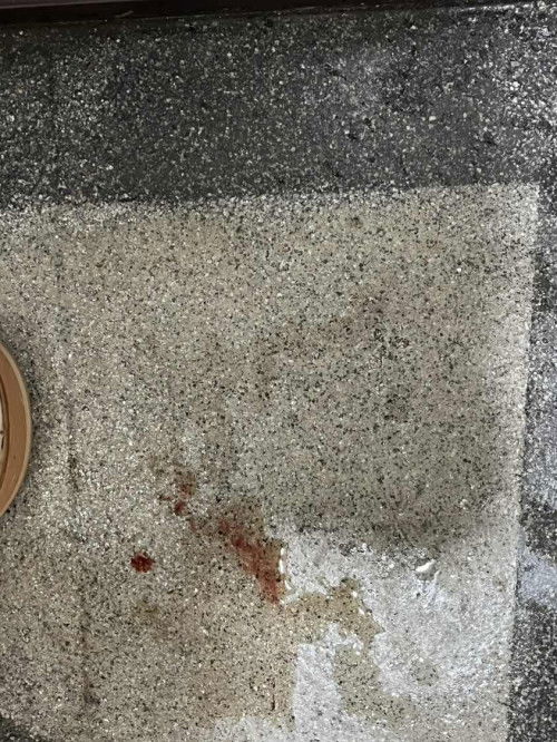 bleeding sikit tapi bahaya tak?