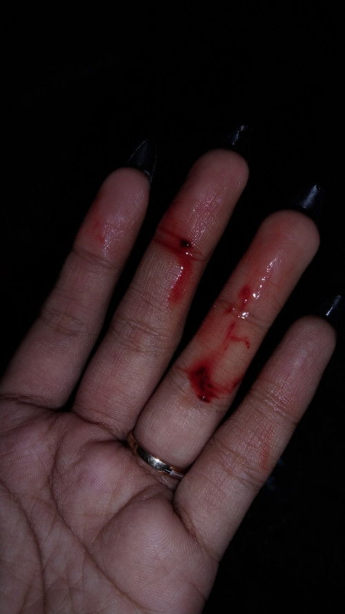 Jatuh keluar darah bnyak