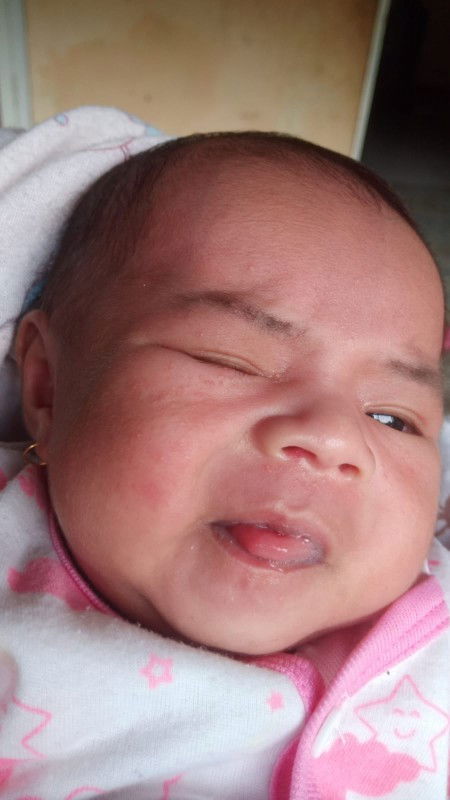 Halo bun. mau nanya, bayi saya baru berusia 19 hari di wajah nya banyak bintik2 merah, kira2 knp ya