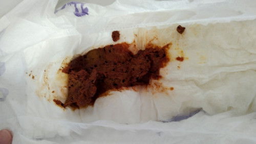 Maaf moomy kalu geli .poo anak saya de warna merah + coklat .