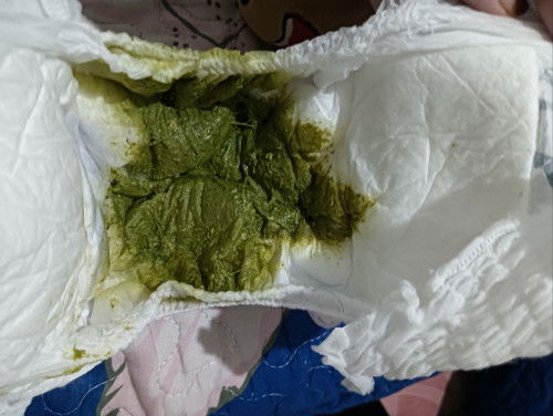 Baby poop hijau