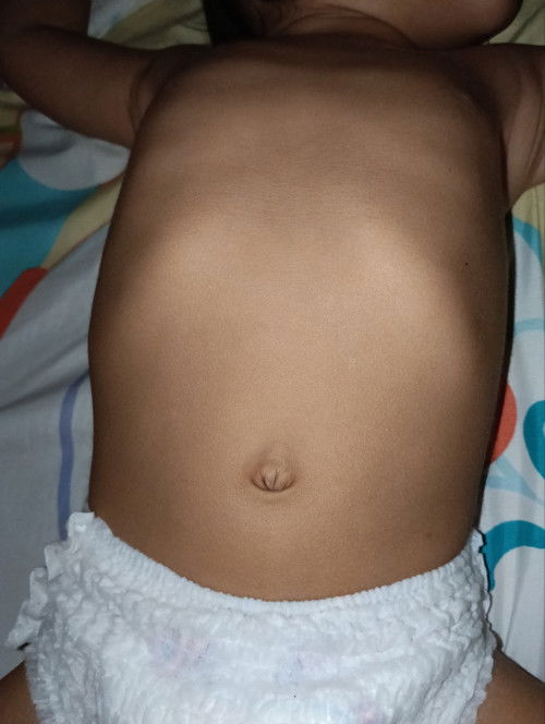 Normal ke kalau waktu baring perut anak macam ne..?