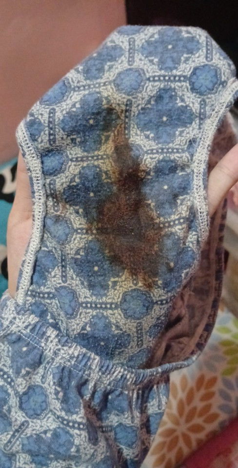 Brown Discharge