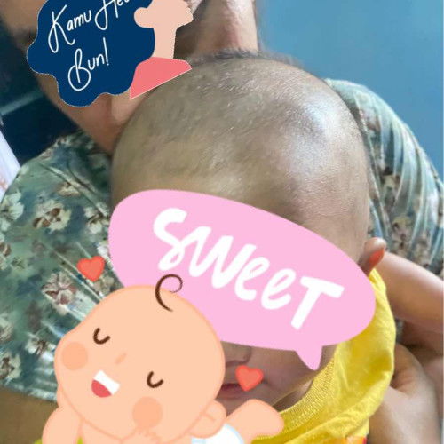 Bentuk kepala bayi usia 4 bulan