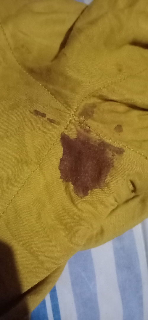 Flek darah Minggu ke 7 seperti ini,bahaya ngk ya Bun,tidak ada tanda nyeri,tapi Nge flek darah
