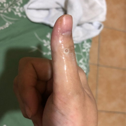 Keluar cairan dari mis V