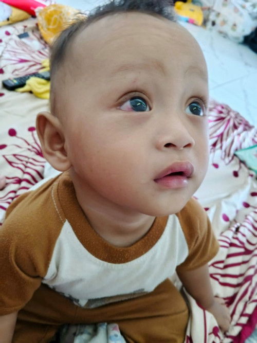 Mata merah