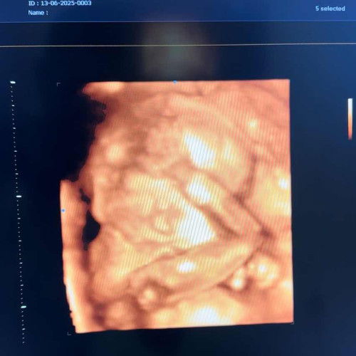 24weeks น้องหนักเท่าไรกันบ้างคะ