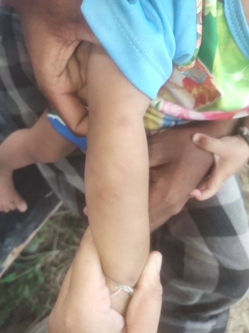 แม่ๆคะน้อง1ขวบมีคนให้น้องทานนเปรี้ยวแล้วนมเปรี้ยวนั้นหมดอายุอันตรายมั้ยคะ/ตอนหนูไปเข้าห้องน้ำค่ะ