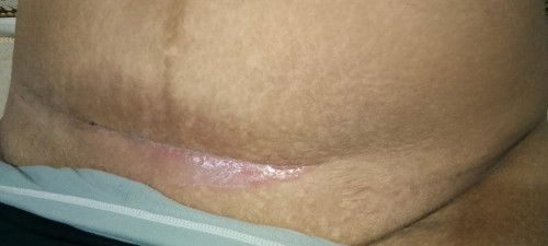 Bekas op sesar