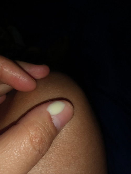 Usia kandungan 19minggu