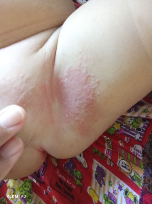 แบบนี้น้องเป็นอะไรคะ