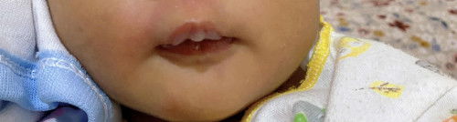 Bibir bayi newborn kering