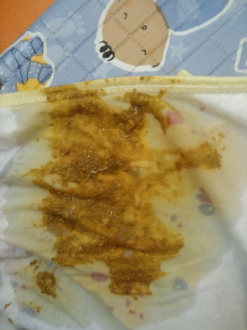 Kuning pada bayi usia 1 bulan