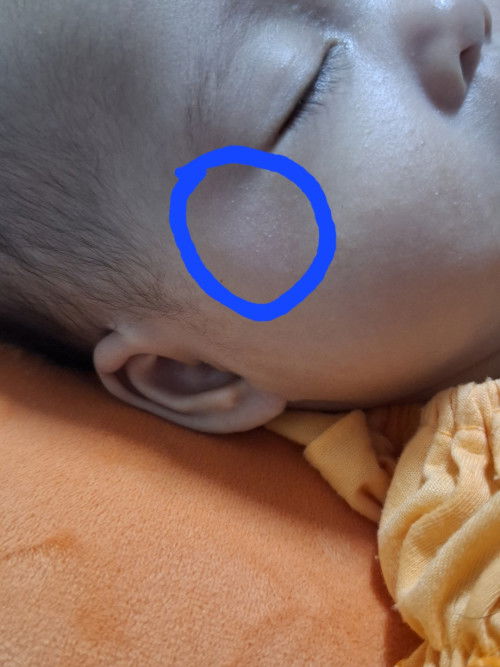เกลื้อนหรือเชื้อราแมวคะ