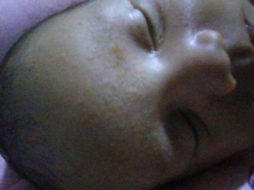 Jidat bayi 1 bulan kasar
