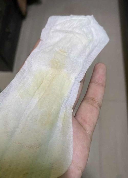 maaf gambar kurang menyenangkan