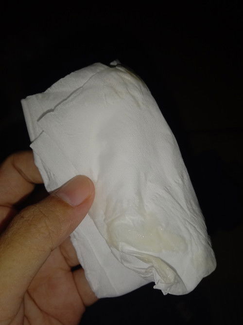 Masa nifas