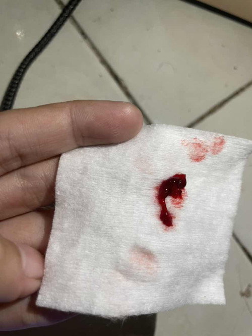 Keluar darah setelah hb