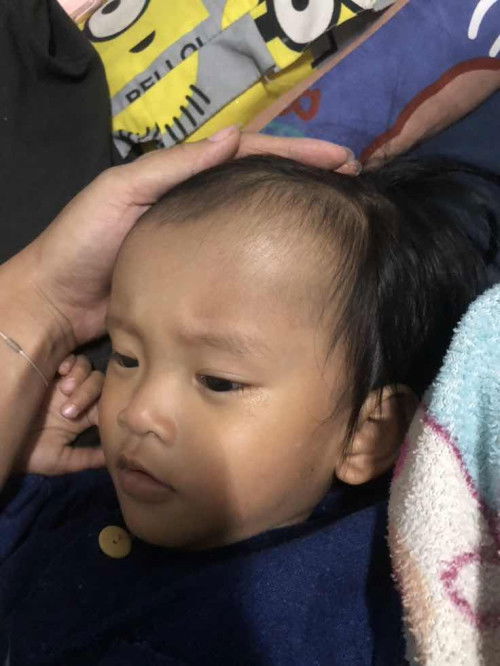 ลูกหัวโนกดแล้วนิ่ม