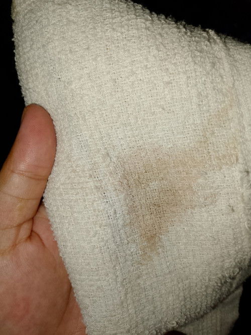 Hello mga mi ano po kaya to? Kagabi puyan , kahit po Ngayon meron paunti unti.