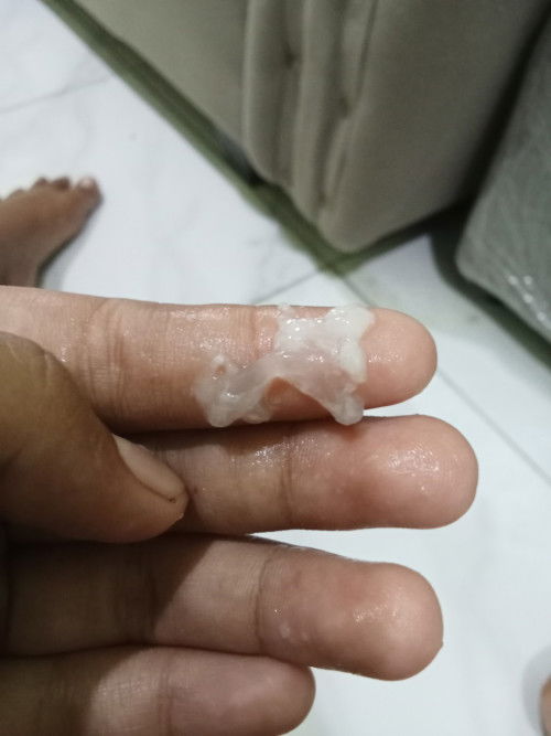Hamil 36 Minggu 4 hari keluar lendir