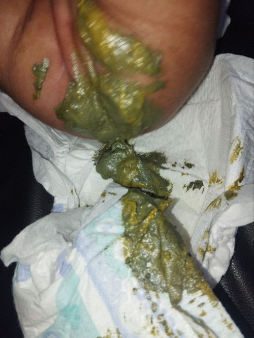 pup bayi warna hijau gelap campur kuning, apakah aman?