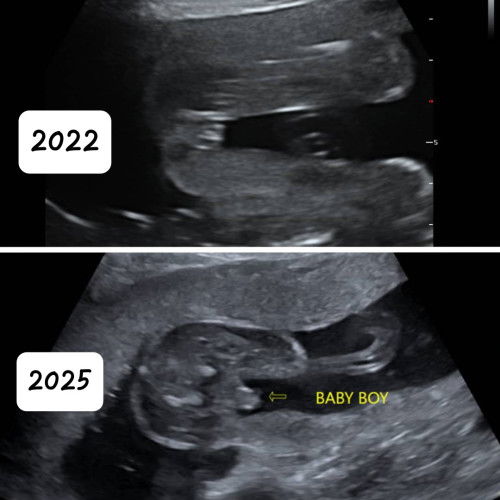 2022 VS 2025