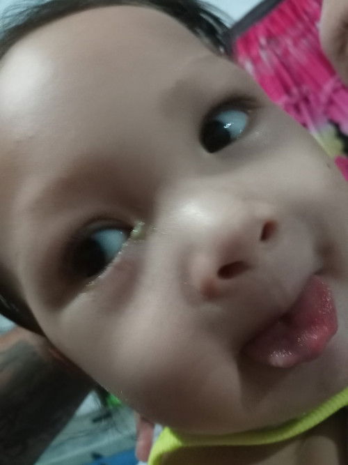 Ano po kaya possible case nentong sa baby ko? Maya maya po siya nagmumuta parang green or yellow