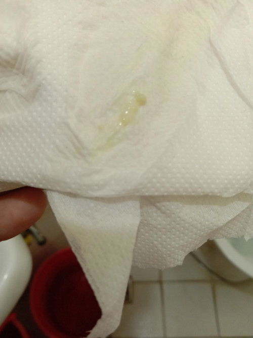 Vaginal discharge