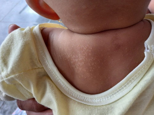 bintik putih pada punggung