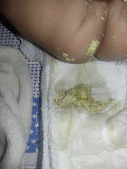 Bun ad yg ngalamin jg ga ya ank sy umr 4bln pup ny biasa nya warna kuning ini pucat bbrp Hr ni.