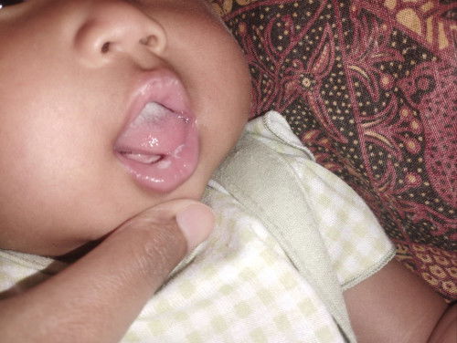 bibir dalam putih