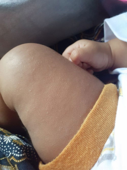 Bayi 2 bulan