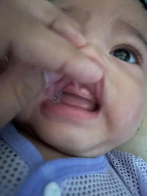 Tumbuh gigi