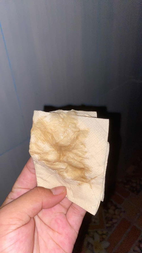 มีมูกใสไปหาหมอเลยไหมมค่า