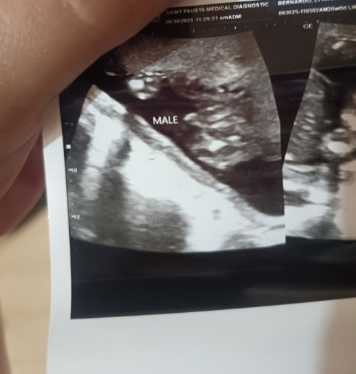 It's a boy! 🩵