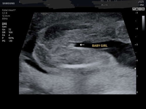 Scan gender