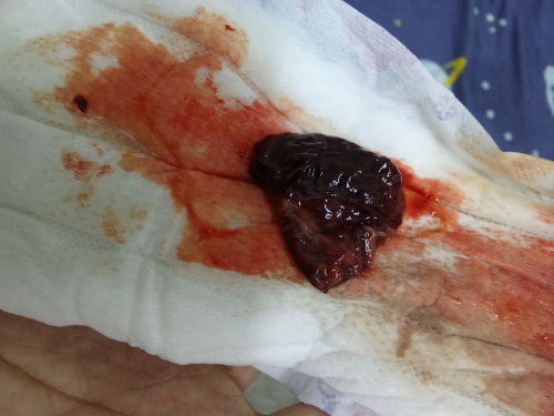 Ni placenta kan ?