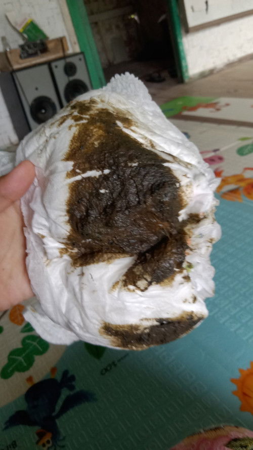 Bab bayi dari 4 bulan hijau tapi tidak berlendir hanya sesekali jika di barengi demam baru berlendir