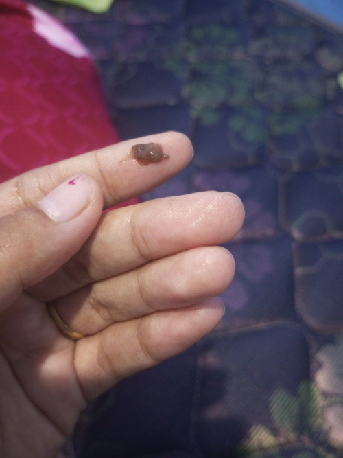 keluar flek cokelat seperti keputihan diminggu k 13 apakah bahaya mom? soalnya baru ini keluar flek