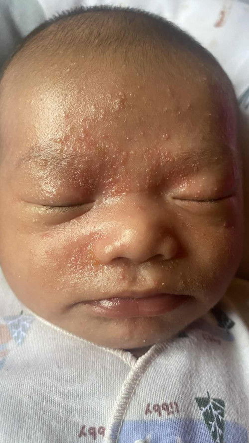 Brutusan pada bayi