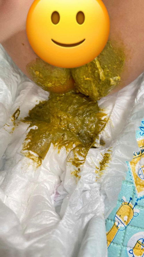 Apakah pup bayi begini bisa di kategorikan mencret